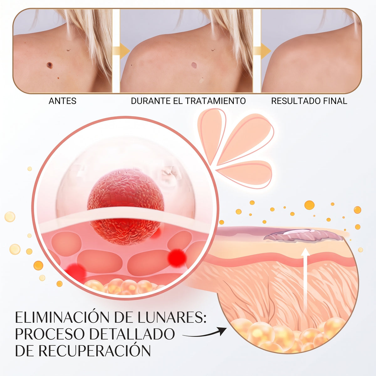 Spray TagRecede™ para el Cuidado Localizado de la Piel